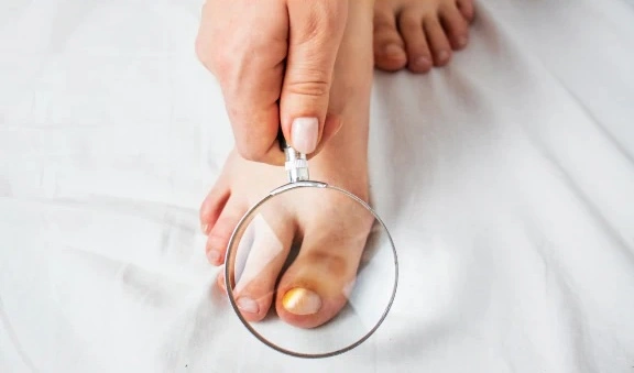 Unhealthy toenail visual