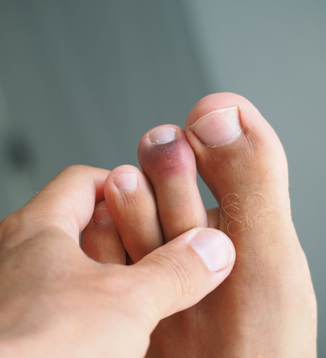 Checking feet for fungus