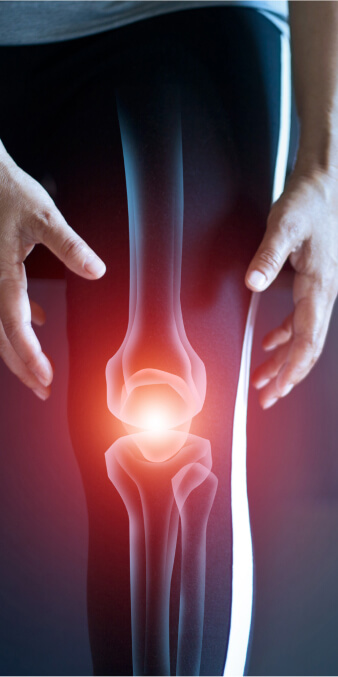 painful knee